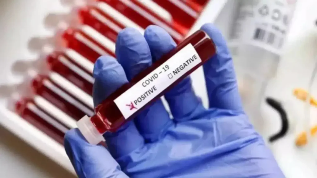 corona-positive-patients-lucknow-121551923